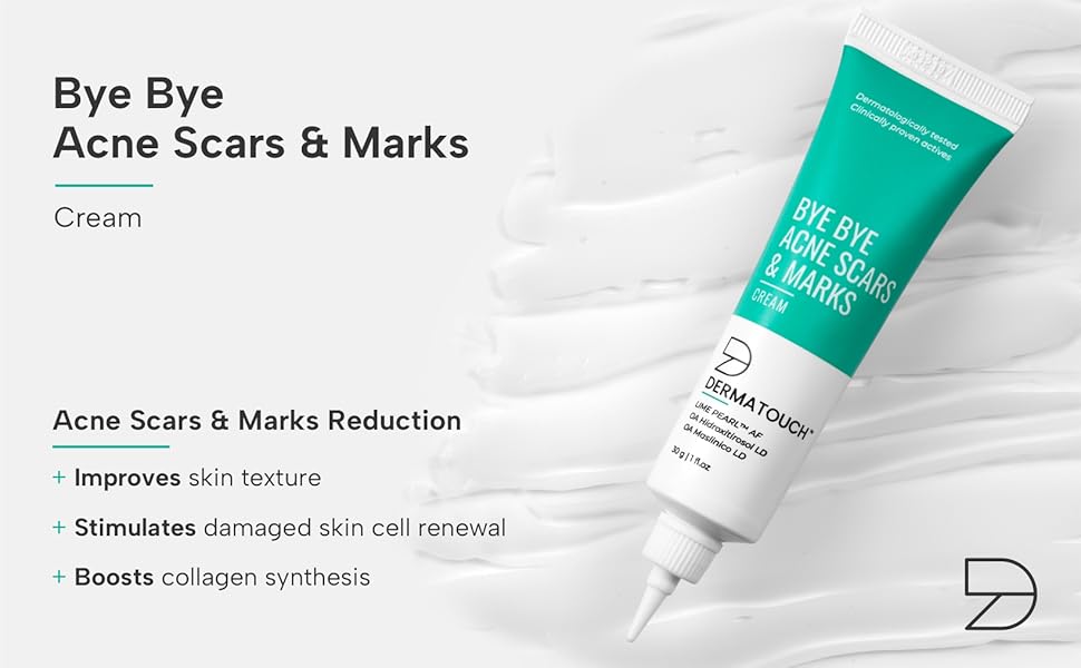 marks removal cream